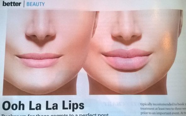 lips-before-and-after